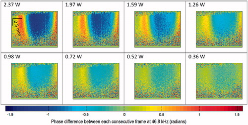 Figure 5. 2D map of phase differences between each consecutive frame at 46.8 kHz with respect to the time after the first TTL trigger, at the shear wave source (HIFU focus, 1.02 MHz, 100 cycles/pulse at 2.37 W acoustic powers). The equivalent limit on the scale bar is −117 to +117 nm displacement difference between each consecutive frame at 46.8 kHz.