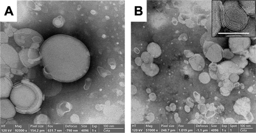 Figure 5 TEM images of LIPO0.5 (A), and LIPO0.5-NUT (B). Bars represent 100 nm.
