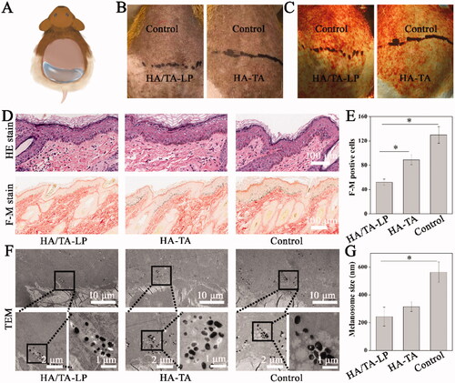 Figure 4. (A) Schematic of topical hyperpigmentation treatment; (B, C) pigmentation alterations and melanin distributions in the different groups; (D) HE staining and F-M staining images; (E) statistical analysis of F-M positive cells (*: p < .05); (F) Ultrastructural characterizations of skin tissues in in the different groups; (G) statistical analysis of melanosomes size (*: p < .05).