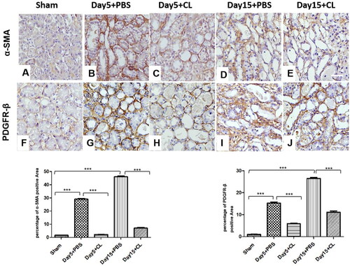 Figure 4. Clodronate liposomes decreased α-SMA and PDGFR-β expression levels following I/R injury. Immunohistochemical staining (IHC) was performed (magnification ×400). n = 10 (***p < 0.001, **p < 0.005, *p < 0.05; scale bar = 100 μm).