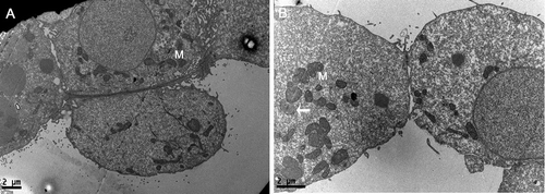 Figure 1. Detection of phagocytic activity in day 5 blastocyst under transmission electron microscope. (A) No evidence of phagocytic activity is observed in the cytoplasm of trophectoderm. (B) One microsphere is found within trophectoderm cell. Short arrow shows the phagocytosed microsphere. M: mitochondria. Bars: (A) 2 μm; (B) 2 μm; 49 x 17 mm (300 x 300 DPI).
