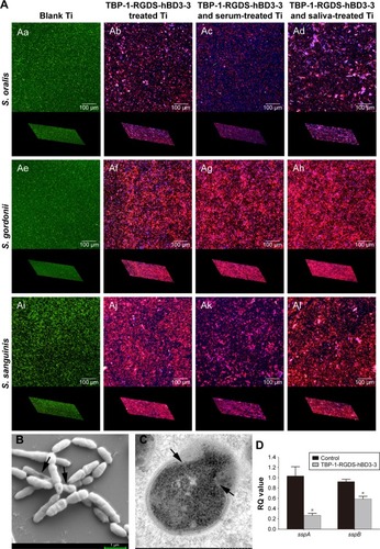 Figure 6 Two-and three-dimensional CLSM renderings of blank Ti, Ti treated with TBP-1-RGDS-hBD3-3, with TBP-1-RGDS-hBD3-3 and serum, or with TBP-1-RGDS-hBD3-3 and saliva, incubated with Streptococcus oralis (Aa and Ad), Streptococcus gordonii (Ae and Ah), and Streptococcus sanguinis (Ai and Al) biofilms for 36 hours. Overlay images show dead cells (red) and living cells (green) stained with AO/EB and TBP-1-RGDS-hBD3-3 (blue) stained with AMC. Scale bar =100 µm. (B) SEM images of S. gordonii biofilms that were treated with TBP-1-RGDS-hBD3-3 at 320 µg/mL for 24 hours. (C) TEM micrographs of the inner structures of S. gordonii that were treated with TBP-1-RGDS-hBD3-3 at 320 µg/mL for 12 hours. Black arrows: disruption of the cell membrane and release of cellular contents. (D) Gene expression of sspA and sspB in S. gordonii treated with TBP-1-RGDS-hBD3-3 or left untreated. S. gordonii planktonic cells (1×108 CFU/mL) and cells that were treated overnight with TBP-1-RGDS-hBD3-3 for 24 hours were harvested for qRT-PCR. *P<0.05.Abbreviations: CLSM, confocal laser scanning microscopy; Ti, titanium; AMC, 7-amino-4-methylcoumarin; SEM, scanning electron microscopy; TEM, transmission electron microscopy; RQ, relative quantification.