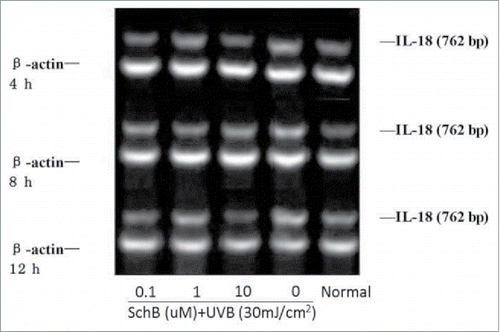 Figure 7. Effect of Schizandrin B on IL-18 expression in HaCaT Cells after UVB-irradiation. Normal: Cells were treated with 0.1% DMSO.