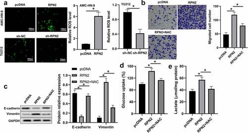 Figure 4. RPN2 functioned via modulating ROS level in LSCC cells. (a) Intracellular ROS levels were examined by DCFH-DA fluorescence. (b) AMC-HN-8 cells transfected with RPN2 overexpressing plasmid were treated with 10 mmol/l NAC for 24 h. Cell migration was assayed by Transwell analysis. (c) Protein levels of E-cadherin and Vimentin were assayed by Western blot in AMC-HN-8 cells after different treatments. (d) Glucose uptake was measured in AMC-HN-8 cells. (e) Lactate production release was evaluated in AMC-HN-8 cells. *P < 0.05.