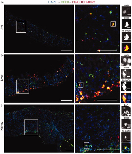 Figure 3. Confocal fluorescence images of murine lung (a), liver (b), and kidney (c) slices exposed to 40 nm PS-COOH nanoparticles. Cross-sections were acquired by confocal fluorescence microscopy after exposure for 48 h to 10 μg/mL 40 nm dark-red PS-COOH nanoparticles in medium supplemented with 5% FBS. The indicated areas are shown at increased magnification to the right. For a and c, scale bars, from left: 200, 100, and 10 μm. For b, scale bars from left: 200 and 100 μm. Blue: DAPI-stained nuclei. Red: nanoparticles. Green: CD68-labeled macrophages (For interpretation of the references to colours in this legend, please refer to the web version of this article.). In the lungs (a), despite the presence of agarose, high nanoparticle uptake into the tissue was observed, and preferential accumulation by macrophages. In the liver (b), nanoparticle uptake into the tissue was clearly visible, as well as high uptake by macrophages, especially at the border of the tissue slices. (b). In the kidneys (c), uptake levels were lower and limited to the first cell layers.