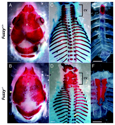 Figure 1. Skeletal preparations of wild-type and Fuz−/− embryos at E18.5. Alizarin red staining marks the bone. Alcian blue staining marks the cartilage. (A and B) Dorsal views of the skull. (A) Control. (B) Mutant mice display synostosis of the coronal suture (yellow arrowhead) as well as an open anterior fontanelle (yellow asterix). (C and D) Dorsal view of the axial skeleton. (C) Control. (D) In mutant animals, the cervical vertebra (cv, bracket) are fused. Ossification of the centrum in thoracic vertebra is lost or aberrant (yellow arrow). (E and F) Frontal views of the sternum. (E) Control. (F) In mutants, the sternum is shorter, hyperossified and cleft/bifid (black arrow).