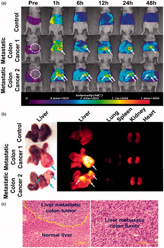 Figure 1. NIRF imaging of liver-implanted CT26 colon tumours. (a) Whole body images of athymic nude mice bearing CT26 colon tumours in their liver tissues after intravenous injection of Cy5.5-P-HA-NPs as a function of time. Arrows indicate the sites of tumours. (b) Ex vivo fluorescence images of tumour-bearing livers and organs excised at 48 h post injection of NPs (5 mg/kg). (c) Representative histological images of normal liver and tumour slices stained with haematoxylin and eosin [Citation42]. Reprinted with permission from American Chemical Society (Copyright © 2011).
