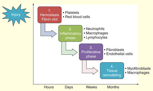 Figure 1. The general phases of wound healing.