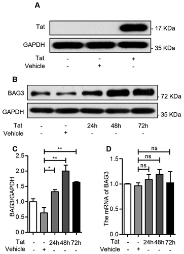Figure 2. HIV-1 Tat upregulates BAG3 in U87 cells