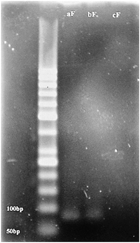 Figure 1. Agarose gel electrophoresis of PCR product. ((af): PCR product of A. flavus. (bf): PCR product of contaminated pistachio. (cf): control experiment without any genes).