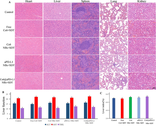 Figure 10 Biosafety evaluation of mice in vivo. (A) The HE staining of major organs (heart, liver, spleen, lung, kidney) treated with different drug groups. Scale bar = 20µm. (B) The blood biochemical indexes of hepatic (ALT, AST and TBIL). (C) The liver index of different drug groups.