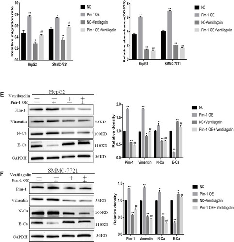 Figure 4 Ventilagolin reverses the facilitative effects of Pim-1 overexpression on migration, invasion, and EMT in HCC cells. (A and B) Pim-1 mRNA and protein expression levels in blank control group (control), negative control group (NC), and Pim-1-overexpressing group (Pim-1 OE) were examined by qRT-PCR and Western blot. Data are expressed as mean ± SEM from three independent experiments. (C and D) Scratch wound healing (10 fields of view) and Transwell chamber (20×) assays were performed when HepG2 and SMMC-7721 cells were grouped by treatment. Data are expressed as mean ± SEM from four independent experiments. (E and F) Protein levels of Pim-1, E-cadherin (E-Ca), N-cadherin (N-Ca), Vimentin in different groups were determined by Western blot using GAPDH as an internal reference. Data are expressed as mean ± SEM from four independent experiments. The relative expression levels were quantified by ProteinSimple analysis software. * and ** respectively indicate significant difference at P < 0.05 and P < 0.01 as compared to the control group; # and ## respectively indicate significant difference at P < 0.05 and P < 0.01 as compared to the Pim-1 OE group.