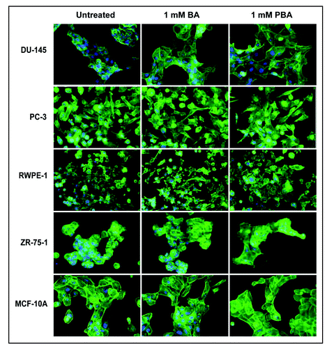 Figure 4 PBA induces spreading of cancer cells on fibronectin. Actin (green) and nuclei (blue) staining of fixed DU-145, PC-3 prostate cancer, RWPE-1 normal prostate, ZR-75-1 breast cancer, and MCF-10A non-tumorigenic breast cells grown on fibronectin for 24 h. Cells were imaged with a 40X objective.