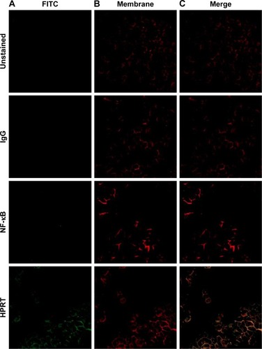 Figure 4 Plasma membrane colocalization with HPRT in H460 cells.