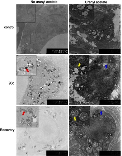 Figure 5 Representative TEM images of lung cells in rats after Carbon black (CB) inhalation and recovery (6000×). Inset: a higher magnification of the lung tissue (12,000×). Alveolar type II epithelial cells in control (Right, staining by uranyl acetate and lead citrate); macrophages in the lung of rats (Left, no uranyl acetate and lead citrate staining). The arrows indicate: Red arrow, CB particles in a lung macrophage; Yellow arrow, mitochondria; Blue arrow, rough endoplasmic reticulum.