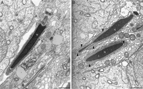 Figure 5. Electron microscopy micrographs of elongated spermatids at step 16 from wild type (A) and from twitcher mice (B). In wild type testis, spermatids have well conformed nucleus and acrosome. In panel B, the twitcher elongated spermatids reveal major structural acrosomal abnormalities. Indeed, the acrosome is redundant, swollen, and detached from the nucleus (arrow heads). N: nucleus; M: mitochondria. Scale bar 2 µm (A,B).