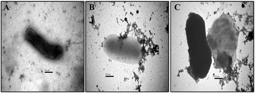Figure 1. Transmission electron micrograph depicting the activity of Ricinusleaf extract on E.coli cell. (A) Control, untreated E. coli cell; (B,C) E.coli cells treated with 50 mg/mL of Ricinus leaf extract.
