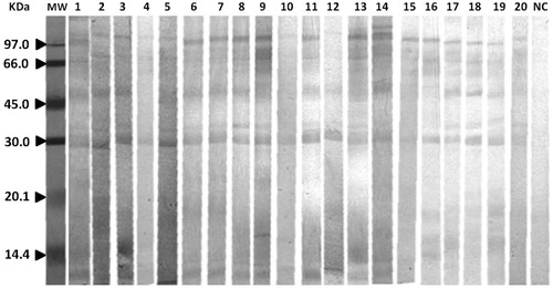 Figure 2. Immunoblotting of H. lepturus venom. Each membrane was first blotted with H. lepturus venom. Each was then incubated with envenomed patients’ sera and evaluated for IgG-reactive bands. Lane MW = low molecular weight markers. NC = negative control.