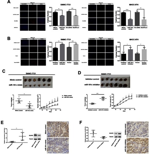 Figure 4 miR-181c regulates the proliferation of HCC cells in vivo and in vitro. (A) EdU proliferation assays were used to detect cell proliferation after transfection with miR-181c mimics and NCAPG siRNA. (B) EdU proliferation assays were used to detect cell proliferation after transfection with miR-181c inhibitors and vector-NCAPG. (C) Tumor weights and volumes in mice injected with miR-181c mimic-transfected SMMC-7721 cells. (D) Tumor weights and volumes in mice injected with miR-181c inhibitor-transfected SMMC-7721 cells. (E) qRT-PCR, western blot and immunohistochemical analysis of miR-181c mimic group and control group mouse xenografts. (F) qRT-PCR, western blot and immunohistochemical analysis of miR-181c inhibitor group and control group mouse xenografts. *p<0.05, **p<0.01, ***p<0.001, ****p<0.0001.Abbreviation: HCC, hepatocellular carcinoma. 