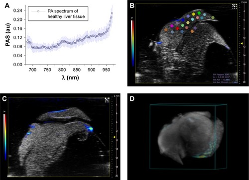 Figure 7 (A) PA spectrum of healthy liver tissue; (B and D) two different PA-US slice images acquired from healthy liver, where some ROIs (0.334 mm2) in which the PA signal was calculated are shown in (B); (C) the 3D PA-US render of healthy liver reconstructed from 176 slices of around 150 µm, the intensity of ultrasound signal in grayscale and PA records in colored bars.Abbreviations: PA, photoacoustic; PAS, photoacoustic signal; ROI, region of interest; US, ultrasound.