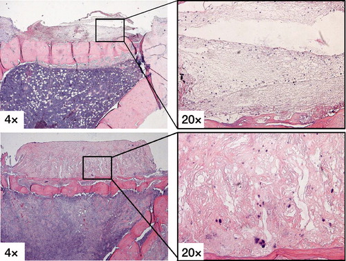 Figure 3. H&E stains showing the fibrous tissue membrane in the immediate loading group (upper row) with a fibrin clot with loose connective tissue after 5 days of loading, while the 5 days latency group (lower row) had dense richly vascularized fibrous tissue.