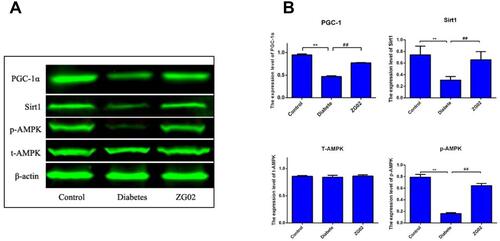 Figure 4 (A) Representative Western blot images of T-AMPK, p-AMPK, SIRT1 and PGC-1 in each group; (B) Quantification of T-AMPK, p-AMPK, SIRT1 and PGC-1 expression in each group. *p<0.01 vs Control group; **p<0.01 vs diabetes group.