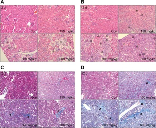 Figure 3 Pathologic changes induced by MSNs in Balb/c mice.Notes: Kidney injury and renal interstitial fibrosis in the control and MSN-treated groups after 2 days and 12 days were detected by hematoxylin and eosin (A and B) and Masson staining (C and D) (magnification 200×), respectively. Because various lesions were observed, numbers were used to indicate the local lesions. 1) Tubular necrosis, 2) tubular eosinophil degeneration, 3) renal interstitial fibrosis, 4) tubular regeneration, 5) renal interstitial lymphocytic infiltration, 6) mesangial cells proliferation, 7) glomerular basement membrane thickening, 8) cellular casts in tubules. In (C and D), the arrows indicate the collagen fiber accumulation in the kidney, which was stained blue with Masson staining.Abbreviations: MSNs, mesoporous silica nanoparticles; d, day(s); con, control.