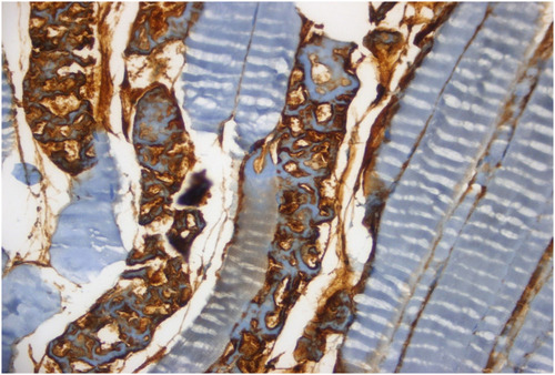 Figure 3 Remarkable caspase-8 staining is seen in muscle fibers and more than fifty percent of the vascular endothelium in I/R group (HE, 40x).