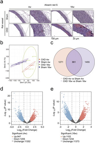 Figure 5. RNA sequencing identified differentially expressed genes in the aortas of CKD–MBD rats at 4 and 16 weeks. a, Alizarin red S staining of rat abdominal aortas. The scale bar ranges from 20 μm to 100 μm. b, Principal component analysis plot of the mRNA expression profiles. c, Venn chart of the numbers of differentially expressed genes. d and e, Volcano plot analysis of differentially expressed genes at 4 and 16 weeks, |Log2FC| > 1 and p < .05. N = 3 for each group.