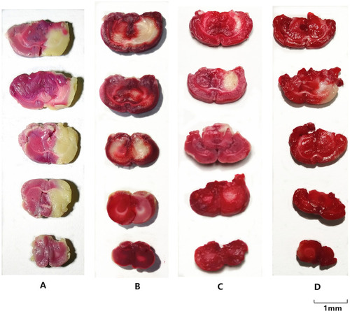 Figure 5 The results of the TTC staining in each groups. (A) I/R group; (B) MCAO model with BA (25mg/kg); (C) MCAO model with BA-LP (25mg/kg); (D) MCAO model with BO-BA-LP (25mg/kg). The infarct area exhibited white, whereas the non-infarct areas were stained red.