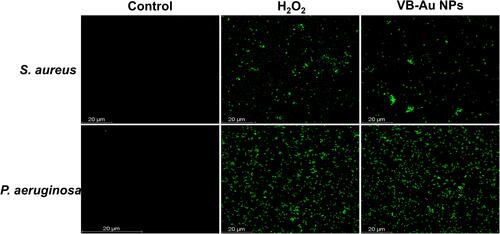 Figure 6 CLSM images of ROS generation in untreated (control) and treated bacteria with hydrogen peroxide (H2O2) and synthesized VB-Au NPs.