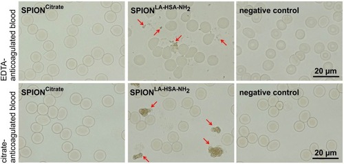 Figure 2 Stability of SPIONCitrate in blood. SPIONCitrate (left) and water used as negative control (right) were stable in EDTA (upper row) and citrate (lower row) anticoagulated blood. Contrary to the aminated particles used as positive control (middle), which aggregated (marked by arrows), SPIONCitrate did not show agglomeration.Abbreviations: EDTA, ethylenediaminetetraacetic acid; SPION, superparamagnetic iron oxide nanoparticle