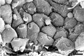 FIG. 10 SEM of the inner surface of the Bowman's capsule of a cyst in a zone with immature parietal podocytes. Note that these cells protrude in the urinary space and are separated by conspicuous intercellular spaces (compare with the parietal podocytes of the Figure 6). Arrows, primary cells process. Bar = 13 μm.