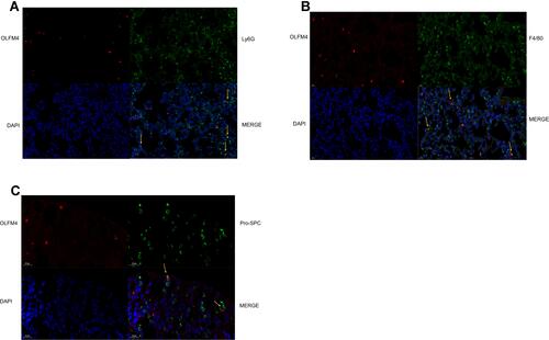 Figure 5 OLFM4 expression was localized in neutrophils, macrophages, and lung epithelial cells. (A–C) Lung tissues of sham mice and CLP mice were double stained to determine the detailed localization of OLFM4. OLFM4 was stained red. Neutrophils, macrophages and lung epithelial cells were marked with Ly6G, F4/80 and pro-SPC respectively in green, and nuclei were stained with DAPI.