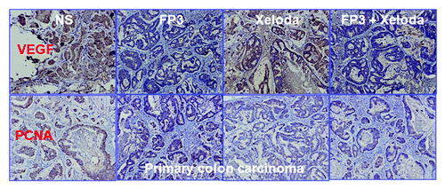 Figure 6. Effects of FP3 and capecitabine (Xeloda) on the expression of VEGF and PCNA in the PDTT xenograft models of primary colon carcinoma. Original magnifications, × 100. Figure 7. Effects of FP3 and capecitabine (Xeloda) on the expression of VEGF and PCNA in the PDTT xenograft models of colon carcinoma lymphatic metastasis. Original magnifications, × 100.