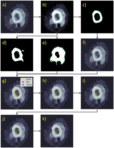 Figure 2. Representative example of the boundary detection procedure for a single slice of an operated limb, segmented using non-adaptive thresholding. The raw slice image (a) was de-noised by applying a Gaussian filter, with a structural similarity index measure (SSIM) of 0.98 with respect to the raw image (b). In this example, preliminary pericortical (c), endocortical (d), and callus (e) boundaries were detected after segmenting with thresholds τperi = 7,000, τendo = 5950, and τcall = 4,250 that differentiated higher density bone from the combined region of all mineralised tissue including callus. The preliminary pericortical boundary (c) was not correct due to cortical remodelling, so a convexity constraint was enforced to produce a more physiological shape (f). Boundaries were then uniformly resampled (g) and smoothed with a savitsky-golay filter (h), which were subsequently cleaned up to remove redundant points (i). Wherever the corrected pericortical boundary was larger than the detected callus boundary, the pericortical radius was collapsed to the detected callus radius (j). In this example, no further change was needed because callus was thicker than 15 pixels along most radial lines (k).