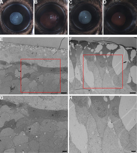 Figure 1. Phenotypic assessment of fyco1 homozygous knockout (fyco1−/−) mice lenses revealed bilateral cataracts and abnormal morphology of lens epithelial and fiber cells. (A–D) Assessment of lens opacities in the knockout mice lenses. The examination identified cataracts in (A) 16-weeks old Ella-Cre-mediated fyco1−/− and (C) 16-weeks old Prm1-Cre-mediated fyco1−/− mice lenses. No cataracts were observed in age-matched (B) Ella-Cre-mediated fyco1+/− and (D) Prm1-Cre-mediated fyco1+/−. (E–H) Transmission electron microscopy (TEM) of wild type (WT) and fyco1−/− mouse lens at postnatal day 60 (P60). The analysis of WT mouse lens revealed a normal morphology of lens epithelial and fiber cells (E, G). In contrast, fyco1−/− mouse lens epithelial cells show extensive vacuolization while fiber cells are large and exhibit irregular shapes (F, H). Note: Image magnifications: 1,850x (E, F), and 3,400x (G, H); Scale bars: 5 µm (E, F), and 2 µm (G, H). Panels G and H are enlarged images of the boxed areas in panels E and F, respectively.