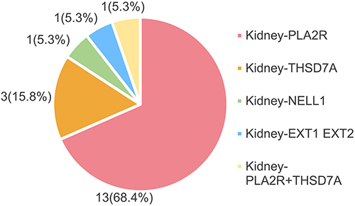 Figure 1 Pie graph depicting frequencies of antigen expression in MN patients with concomitant malignancy in our center.