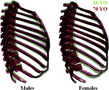 Figure 2 Comparison of 30- and 70-YO male and female morphed models.