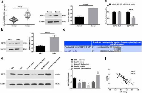 Figure 4. miR-15a-5p targets SEPT2. A-B. RT-qPCR and Western blot tested SEPT2 expression in tissues and cells; C. Targeting site between miR-15a-5p and SEPT2; D. Dual luciferase reporter gene assay tested the targeting of miR-15a-5p and SEPT2; E. Western blot tested SEPT2 expression in G-401 cells after co-culture with hUC-MSCs-Exo; F. Pearson analyzed the correlation between miR-15a-5p and SEPT2. Measurement data were shown by the mean ± standard deviation, # P < 0.05 vs the PBS group; * P < 0.05 vs the Exo-NC mimic group; $ P < 0.05 vs the Exo-NC inhibitor group.