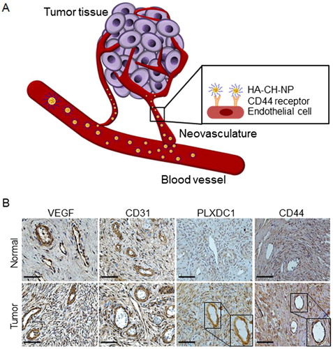 Figure 1. Schematic illustration of CD44-targeted delivery of HA-CH-NP/siRNA as a selective PLXDC1 siRNA delivery carrier for anti-angiogenesis tumor therapy. (A) Overview of this study. (B) Expression of PLXDC1 in normal tissues and in ovarian tissues from ovarian cancer patients. Scale bars indicate 50 µm.