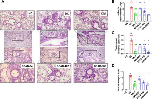 Figure 5 SPAB ameliorates airway inflammatory histo-pathological changes. Lung tissue sections were assessed for airway inflammation using H&E staining. (A) H&E stained lung tissue sections of NC, DC, DM-2 mg/kg, SPAB-34 mg/kg, SPAB-102 mg/kg and SPAB-306 mg/kg. Quantitative analysis of (B) Leukocyte recruitment in lungs, (C) Thickening of bronchial epithelium and (D) Total pathological score. Arrow points at either leukocyte accumulation or thickening of bronchial wall. Data were presented as the means ± S.E.M (n= 4–6). **, ##p < 0.001 and *p < 0.05 by one-way ANOVA; ## Represents significant compared to NC and *Represents significant compared to DC (Scale bar indicates 100 µm and 20 µm).