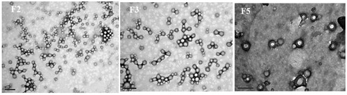 Figure 2. TEM images for HCPT-PLGA nanoparticles F2, F3 and F5.