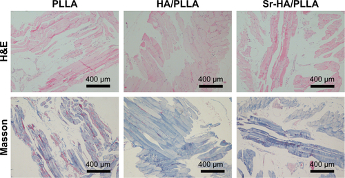 Figure S2 Histological images of scaffolds and surrounding tissue in mice stained with H&E and Masson.Abbreviations: H&E, hematoxylin and eosin; PLLA, poly(l-lactic acid); HA/PLLA, hydroxyapatite on porous poly(l-lactic acid); Sr-HA/PLLA, strontium-doped hydroxyapatite on porous poly(l-lactic acid).