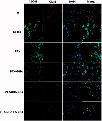 Figure 9. Confocal laser scanning microscopy images of macrophages after treatment with PBS, PTX, PTX + DHA, PTX/DHA-LNs, and PTX/DHA-FA-LNs. Cell nuclei were stained with DAPI (blue), CD86 fluorescence displayed in red and CD206 fluorescence displayed in green. Scale bar represents 20 μm. Data represent mean ± SD (n = 3).