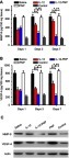 Figure 4 Measurement of cytokines in rat retina after intravitreal IL-12 or IL-12-PNP injections. After various time periods, cytokines were analyzed by ELISA (A and B). One-way ANOVA and Newman-Keuls post-hoc test were used to determine differences among ≥3 groups. *P<0.05; **P<0.05 . Data are mean ± SD (n=3). On day 7, retinal tissue protein was extracted for Western blot analysis (C). Representative Western blot from three independent experiments.