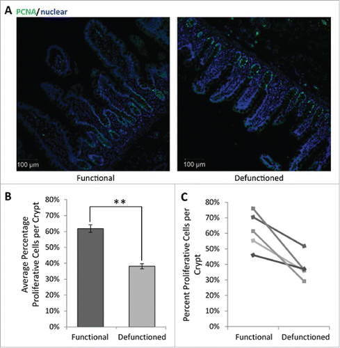 Figure 7. (A) Representative immunofluorescent PCNA labeling (green) to measure proliferation. All nucleated cells, counterstained using Hoechst 33342, are colored blue. Magnification 10x. (B) Average percent proliferating PCNA positive cells/crypt ± SEM (n = 5; p = 0.01). (C) Paired percent PCNA-positive cells per crypt in the functional and defunctioned intestine.