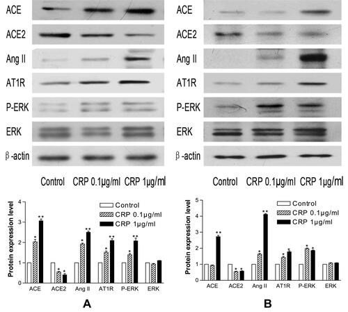Figure 2 Representative Western blots of CRP on RAS/ERK pathway in 3T3-L1 adipocytes (A) and VSMCs (B). The quantitative results are shown below (n=6). Data are expressed as mean ± SD,*p<0.05 versus control; **p<0.01 versus control.
