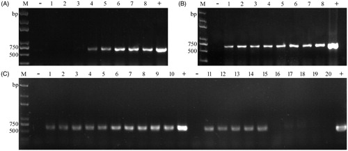 Figure 1. Colony PCR amplification of hph from transformants of YLCs of T. fuciformis by changing parameters. (A) Under different concentrations of Lywallzyme treatment (2.5, 1.25, 0.625, 0.3125, 0.25, 0.125, 0.0625, and 0.03125%). 1–8: the same transformant; (B) Under the optimized enzyme concentration treatment for different times (15, 30, 45, 60, 75, 90, 105, and 120 min). 1–8: the same transformant; (C) Comparison between using the suspension and the supernatant both extracted under 0.25% Lywallzyme for 15 min; comparison between using the unheated suspension and the suspension followed by an additional boiling step at 100 °C for 5 min. The suspension was extracted under 0.25% Lywallzyme for 15 min. 1–5: using the supernatant as template. 6–10: using the suspension as template. 11–15: using the unheated suspension as template. 16–20: using the heated suspension as template. 1–10, 11–20: the same transformant. M: Trans2K plus DNA marker (Transgen, Beijing, China), −: negative control; +: positive control.