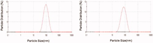 Figure 2 Zeta sizer measuments of MIP (a) and NIP (b).